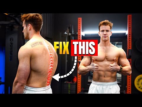 Fix Your Pelvic Tilt FAST (Anterior & Posterior)