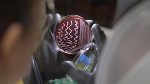 Gut microbiome tests are everywhere. Should you get one?