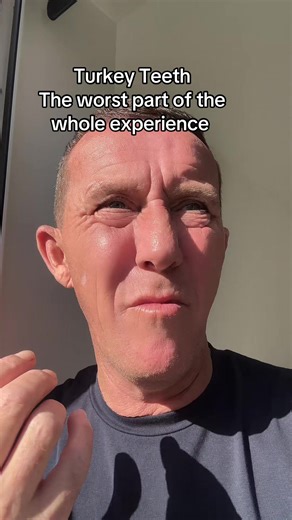 Top Dislikes from My Dental Implant Journey
