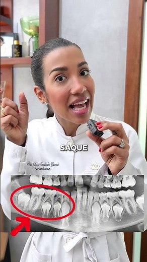 LET'S TALK ABOUT THE FIRST PERMANENT MOLAR #dentist #molars