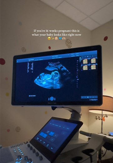 16 Weeks Pregnant: Exploring Your Baby's Ultrasound