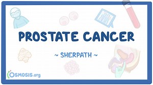 Prostate cancer: Nursing pathophysiology: Video, Causes, & Meaning | Osmosis