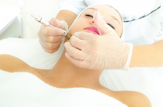What to Expect During Your First Microdermabrasion Treatment