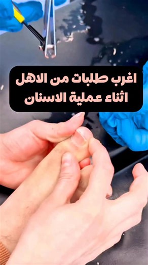 Dr.Luma on Instagram‎: "⁨ ⁨ بس نكول الله يكون بعونهم 🙏🏻 شكد يجونه اهالي يطلبون منه امور احنه نعتبره عاديه بس همه ميكدرون يسووه لاولادهم من ذوي الاحتياجات الخاصه ، مثل المعاناة بقص الاظافر ، هوايه نشوف اظافيرهم طويله. ومو نظيفه لان ميقبل احد يكرضله ، ومرات حته يجرح نفسه بيها مرات الاهل يحاولون يسووها اثناء مينام ، بس اكو حته بالنوم ميكدرون فيطلبون من عدنه وره منخلص علاج الاسنان و قبل ميكعد من التخدير انو نكص الاظافر واكو عدهم معاناة بقص الشعر ، واكو يردون يسوون تراچي للبنيه وغيرها #علاج_اسنان_ذ