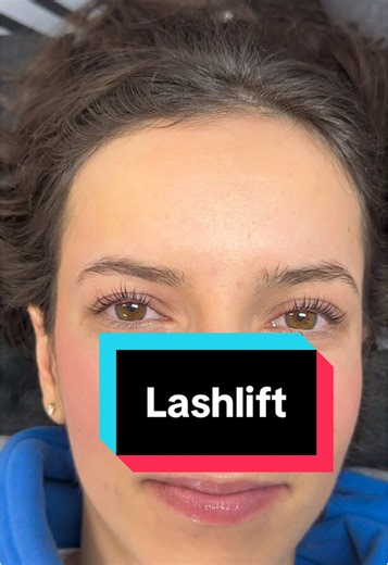 Lash Lift Results: Stunning Before and After Transformations