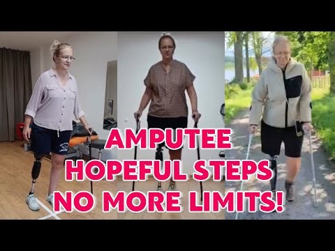 Amputee woman Life After Amputation: Walking training with mobility aids