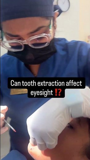 Can Removing a Tooth Damage Your Eyes? Myth Busted! #dentaleducation #dentalmyths