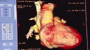 How to lower your resting heart rate