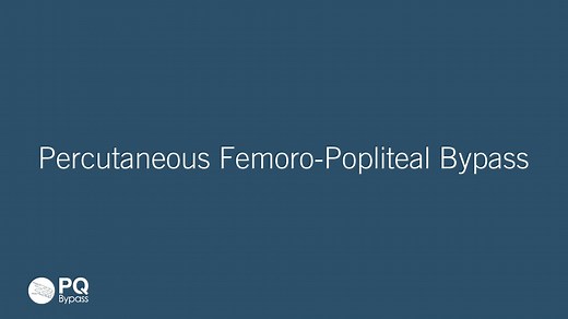 PQ DETOUR PROCEDURE: Percutaneous Femoral-Popliteal Bypass