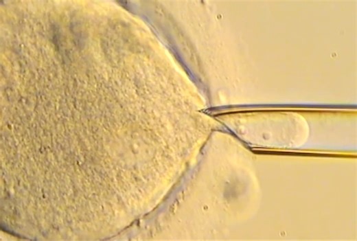 Babies born from ‘three-parent’ IVF look healthy so far, new study finds