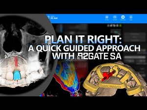 R2GateSA Tutorial Series | Clinical 4 : Quick Guide and R2One2