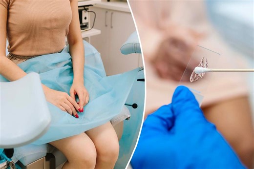 Hate your Pap smear? An at-home screening could replace it for women over 30, say new US guidelines
