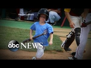 Bat Boy, 9-Years-Old, Killed by Bat