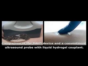 Engineers develop stickers that can see inside the body