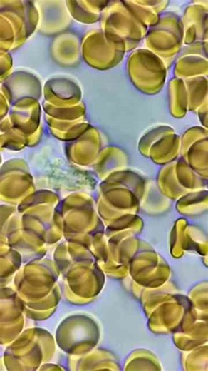 White blood cell searching for bacteria/virus under the microscope!