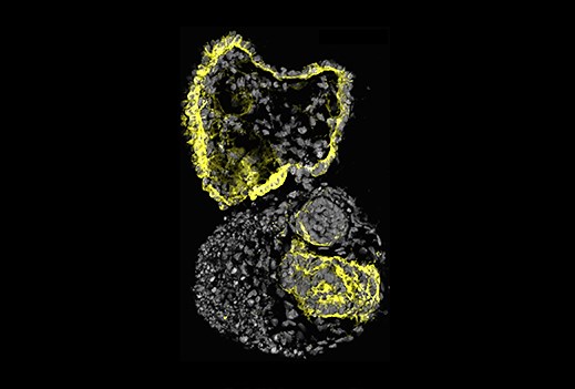 USC Stem Cell scientists use mini-kidney models to identify potential drugs for polycystic kidney disease