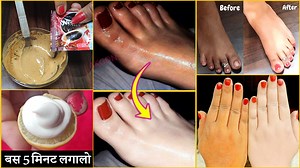 749K views · 10K reactions | हाथ-पैरों, गर्दन पर सालों साल जमी मैल व...