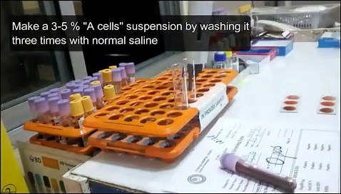 Forward and reverse blood grouping test in lab | slide and tube method for beginners