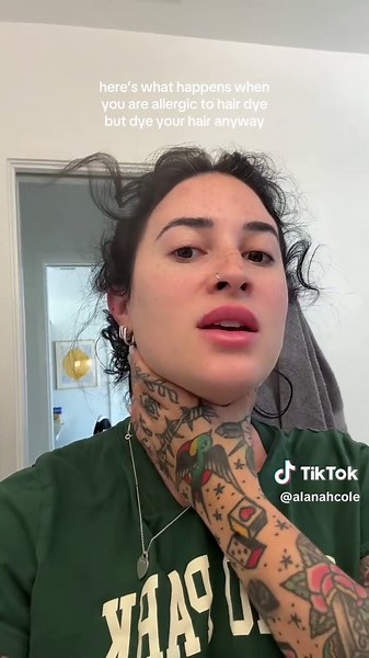 What to Expect from Hair Dye Allergic Reactions