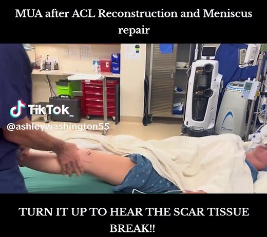 ACL & Meniscus Recovery: Scar Tissue Break!