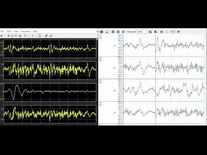 Comparing the different approaches of EEG data visualization
