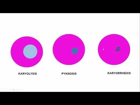 MORPHOLOGY OF CELL INJURY: REVERSIBLE & IRREVERSIBLE. Necrosis & its types.