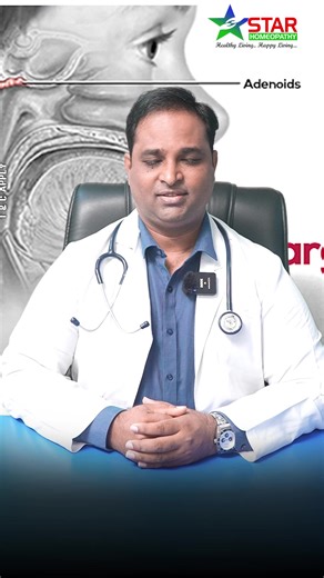 Adenoids troubling your child? Frequent cold, mouth breathing, snoring, or blocked nose? 😷 Get lasting relief with Star Homeopathy’s natural Adenoids treatment! 🌿 ✅ No surgery ✅ No side effects ✅ Strengthens immunity & improves breathing naturally 💚 Let your child sleep & breathe peacefully again! 🌸 📞 Book your free consultation: 9243033999 🌐 Visit: www.starhomeopathy.com Visit Our Branches : Kukatpally, Warangal, Vizag, Vijayawada Secundrabad, Kothapet, Tirupathi, Rajahmundry T & C Apply!