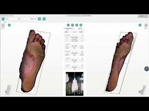 USOL 3D Laser Foot Plantar Scanner