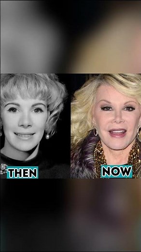 50+ Celebrity Plastic Surgery Disasters | Before and After4