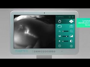 FLUOBEAM® IN ACTION - Lymphatic surgery - Sentinel node biopsy