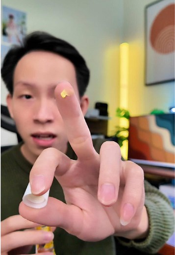 Giải pháp bôi viêm da cơ địa hiệu quả