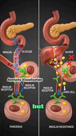 What Is Insulin and How It Works Inside Your Body