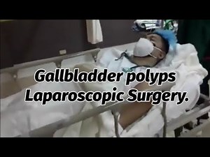 SURGERY : LAPAROSCOPIC CHOLECYMTECTOMY gallbladder polyps.