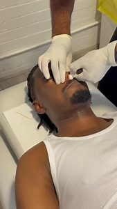 Ever wondered what Cranial Facial Release (CFR) is? 👇 CFR is a gentle technique where a small balloon is placed in the nasal passages and carefully inflated. This helps release tension in the bones of the skull and face, improving alignment and function. How it works: 💨Opens nasal passages and improves breathing 💨Releases deep fascial tension in the face and head 💨Can help reduce headaches, sinus pressure, and jaw discomfort 💨Supports optimal neurological function & cerebrospinal health Dr 
