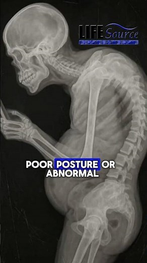 Disc Degeneration & Low Back Pain? How Spinal Decompression Therapy Works.