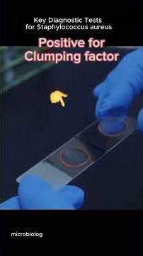 ‪@MicrobiologyInsider‬ #key #diagnostictroublecode #kit ‪@viralvibes-d2g‬ ‪@scienceandfun‬