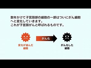 HPV感染から子宮頸がんになるまで