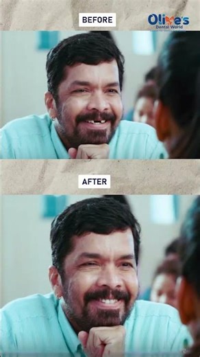 How to Save a Knocked-Out Tooth After an Injury | Olive’s Dental World