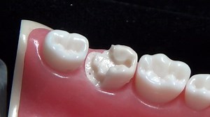 Dr Rivera , Core BUILD UP