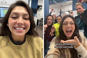 Woman’s Journey To Get New Teeth After Hers Were Pulled Out At Age 20 Goes Viral