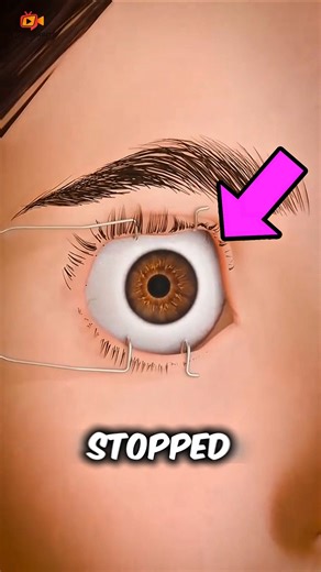 What Happens If You Stop Blinking?