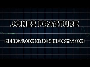 Jones fracture (Medical Condition)