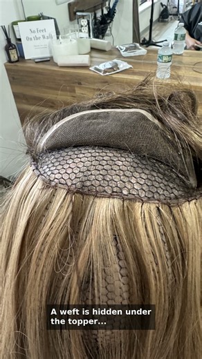 Trichotillomania Hair Loss to Full Hair in One Visit | Boston Hair Loss Specialist
