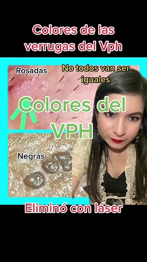 Mira las cepas del Vph #vph #vphhombre #vphmujer #papilomahumano #sigeme #verrugasdelvph #agend #sigem #verrugasgenitales #condilomas