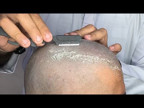 Hard dandruff remove Head shave tutorial zaibi barber shop 2026