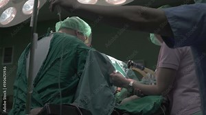 Active scene of surgery operation in operating room, a team of surgeons using surgical tools to processing male mature patient by assistance of nurses and female anesthesiologist, crane shot,close up