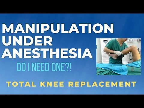 Manipulation Under Anesthesia (FULL DETAILS) Total Knee Replacement