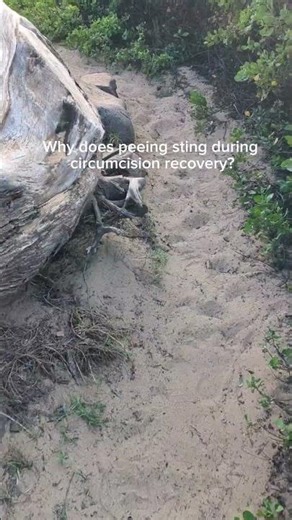 Circumcision recovery issues #circumcision #postop #menshealth #urinaryissues #recovery