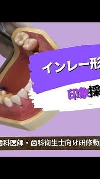 インレー形成＃6「印象採得編」