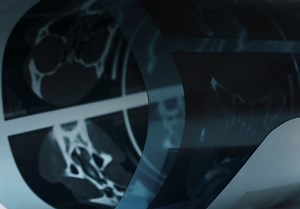 How to Help Patients Cope With Loss of Taste and Smell